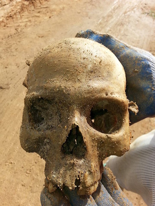 Skull found at construction site was 35-40 year-old male, analysis finds